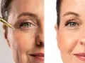 Prima e dopo: un siero dona alla pelle luminosa un aspetto più giovane e levigato.