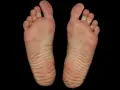 Piante dei piedi con evidenti calli e rughe, segno di lunghe camminate.