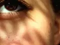 Occhio con striature rosse, forse un segno di allergia al sole. La luce solare crea ombre sul viso.
