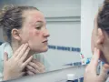 Donna con viso arrossato e irritato si guarda allo specchio, preoccupata che la glicerina viso fa male.