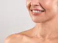 Sorriso radioso, pelle luminosa e le prime collane di Venere a 20 anni, segno di giovinezza e vitalità.