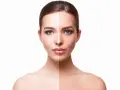 Volto diviso a metà: da un lato pelle chiara, dall'altro abbronzata, per mostrare come aumentare la melanina.
