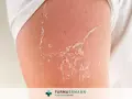 Pelle che si desquama dopo un'esposizione solare. Scopri come togliere la pelle morta dal corpo in modo delicato.
