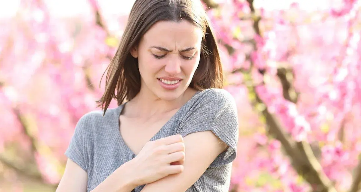 Donna con prurito in tutto il corpo, graffiandosi il braccio tra i fiori rosa.