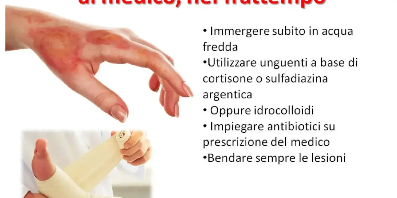 Immagine mostra una mano ustionata e un piede fasciato. Per le ustioni, cosa mettere: acqua fredda, unguenti specifici o idrocolloidi, e bendare. Consultare sempre un medico.
