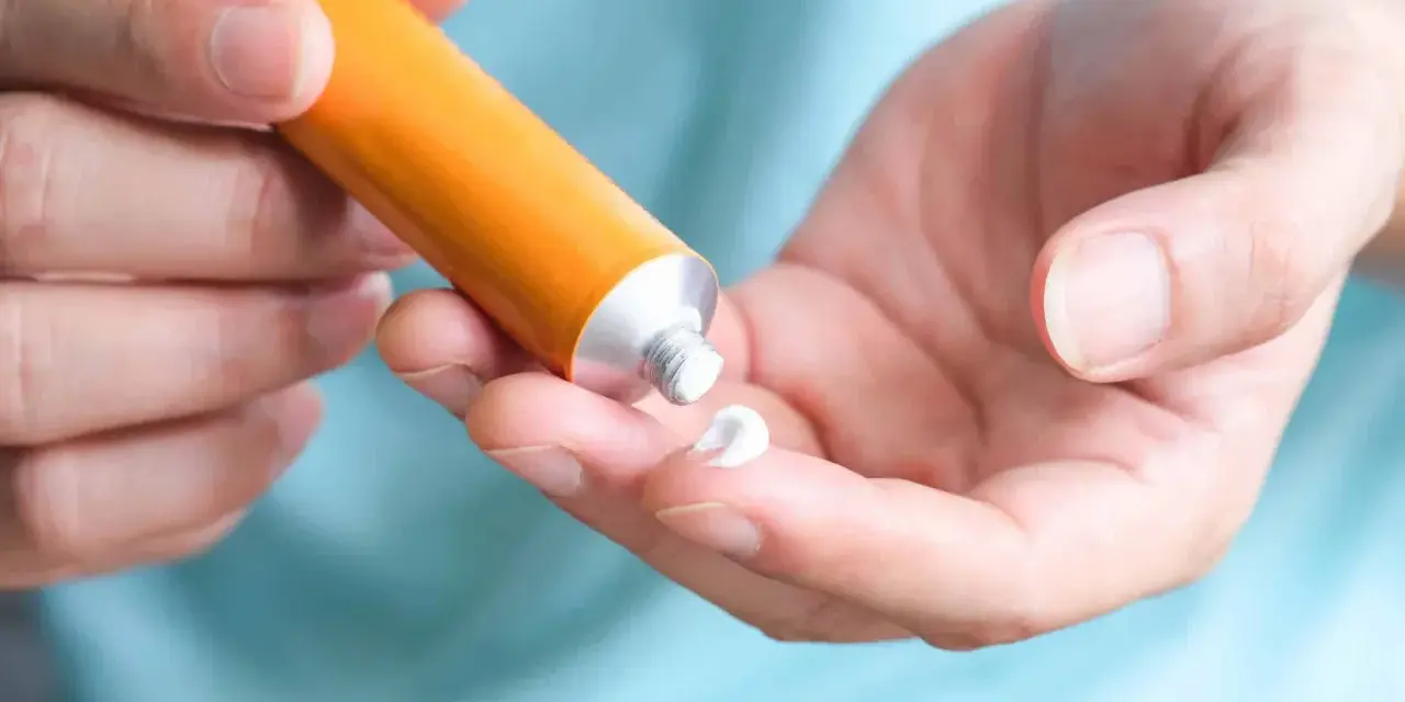 Mano che applica crema al cortisone su un dito, per alleviare la dermatite atopica.