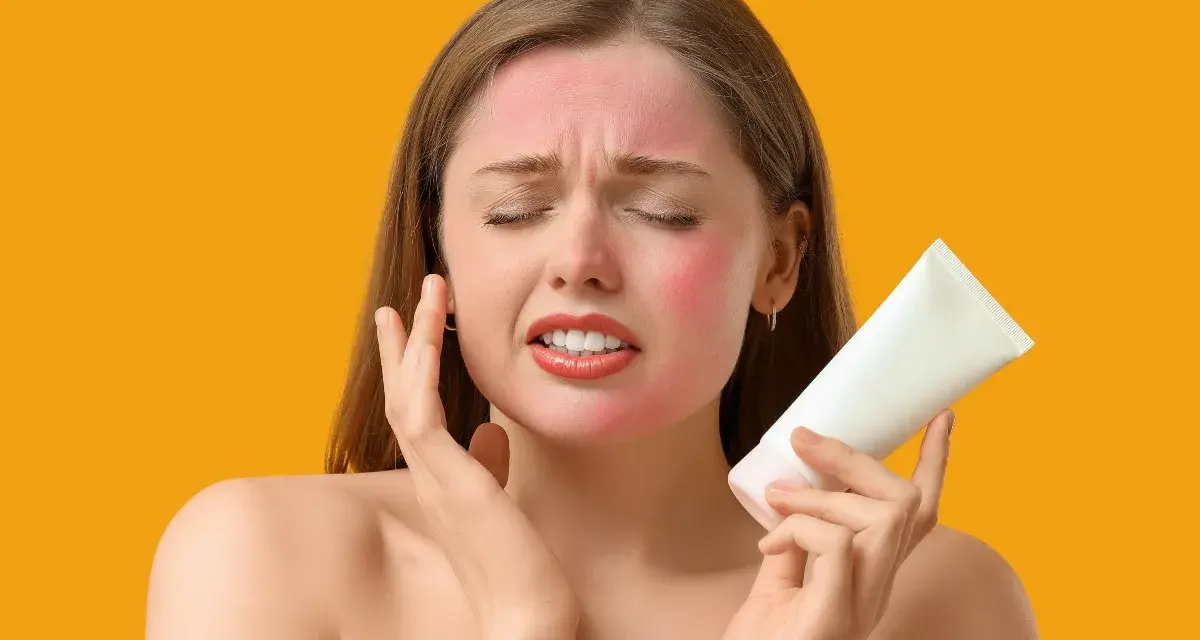 Donna con viso arrossato per eritema solare, che tiene in mano una crema. Potrebbero comparire brufoli a causa dell'irritazione.
