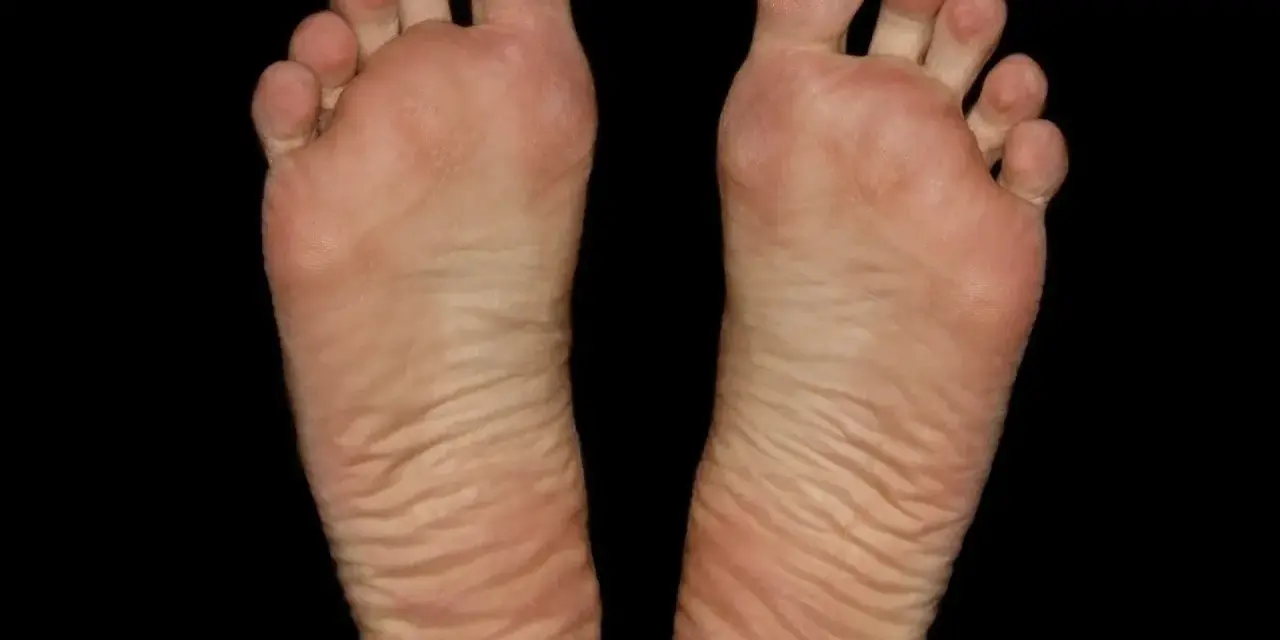 Piante dei piedi con evidenti calli e rughe, segno di lunghe camminate.