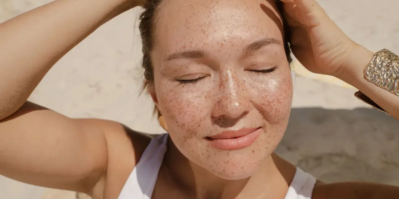Donna con lentiggini al sole, con le mani tra i capelli. Forse la crema solare tutti i giorni fa male?