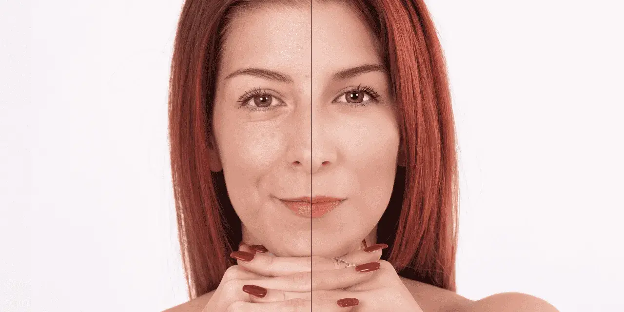 Prima e dopo: il collagene a cosa serve per una pelle visibilmente più liscia e luminosa.