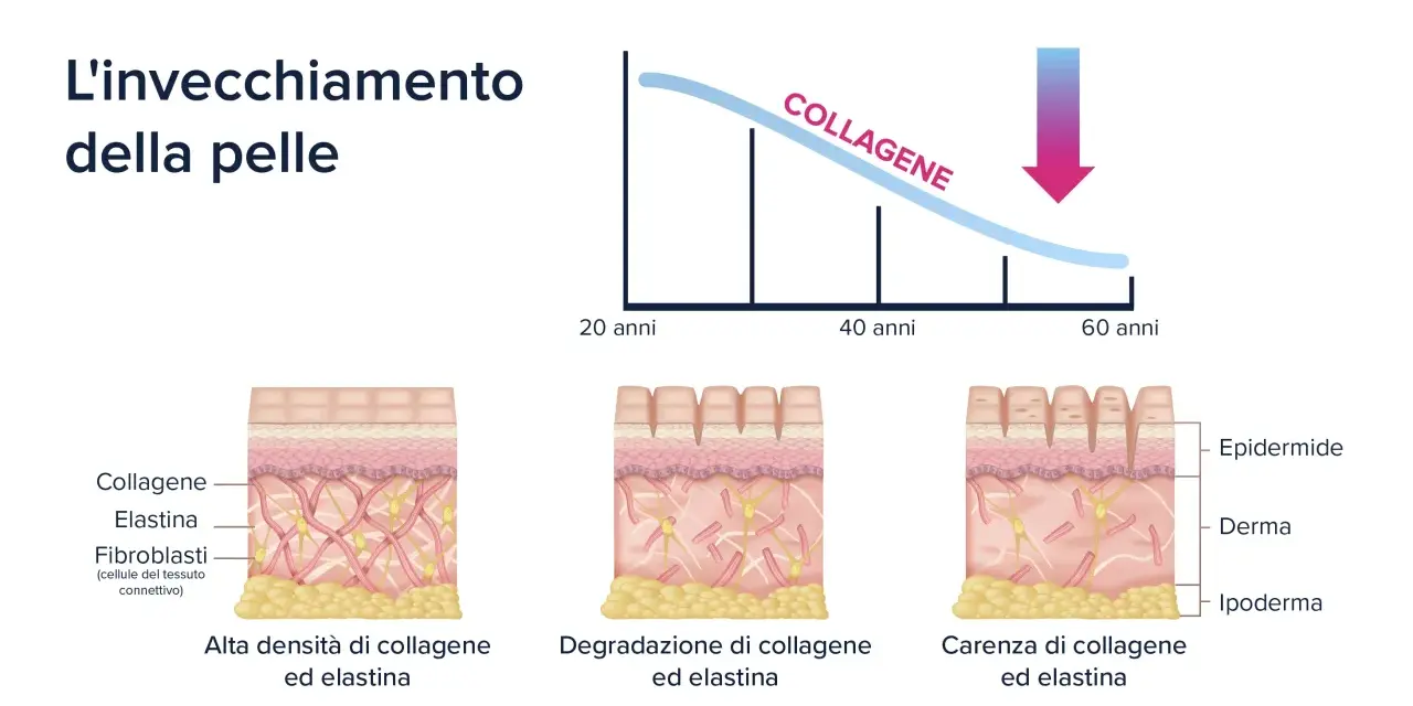La pelle invecchia: il collagene diminuisce con l'età, causando rughe e perdita di elasticità. Sembra che sono invecchiata di colpo!