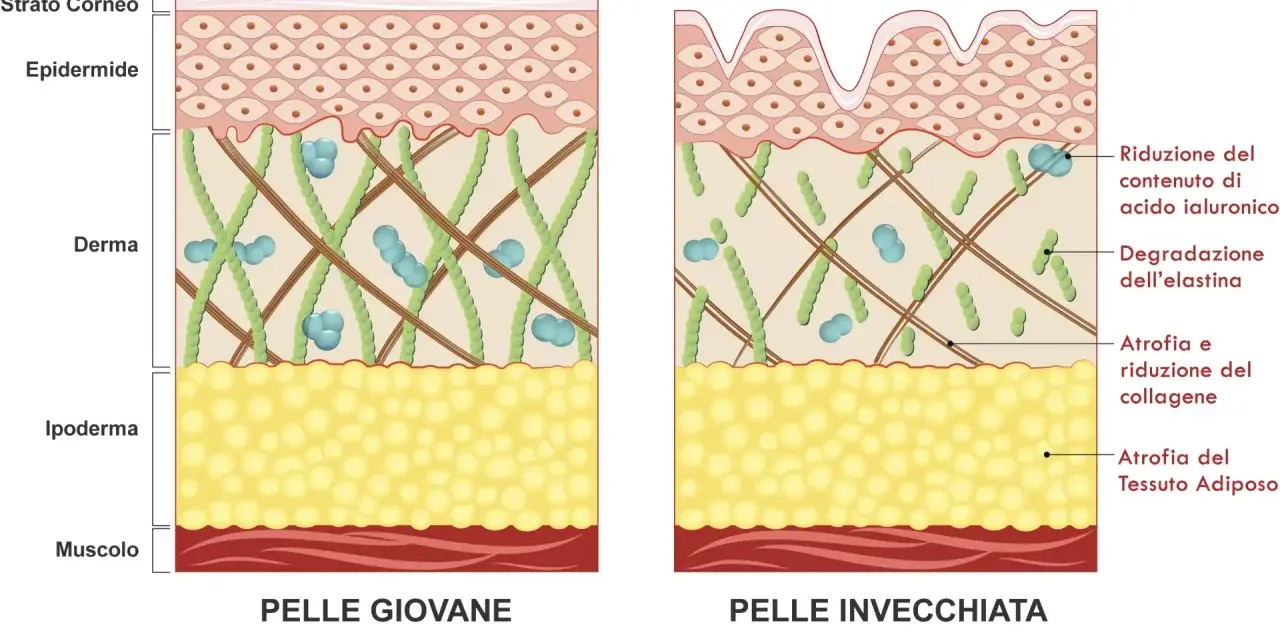 Confronto tra pelle giovane e pelle invecchiata: l'invecchiamento della pelle mostra riduzione di acido ialuronico, collagene, elastina e tessuto adiposo.