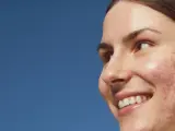 Primo piano di una giovane donna sorridente con pelle imperfetta, dove spicca un brufolo rosso.