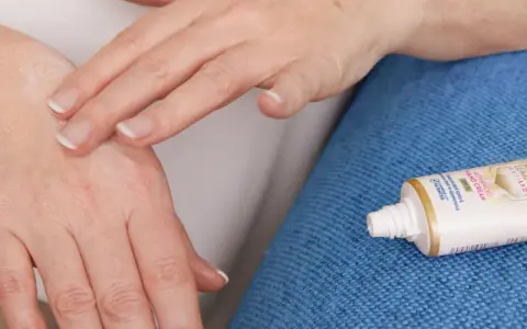Mani che si toccano, alleviando rossore e prurito tra le dita. Accanto, un tubetto di crema Nivea.