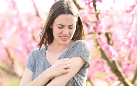 Donna con prurito in tutto il corpo, graffiandosi il braccio tra i fiori rosa.