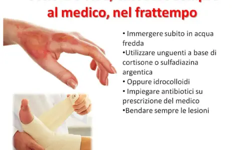 Immagine mostra una mano ustionata e un piede fasciato. Per le ustioni, cosa mettere: acqua fredda, unguenti specifici o idrocolloidi, e bendare. Consultare sempre un medico.