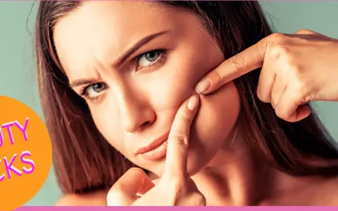 Donna preoccupata che cerca consigli su come togliere i punti neri dal naso in casa.