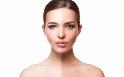 Volto diviso a metà: da un lato pelle chiara, dall'altro abbronzata, per mostrare come aumentare la melanina.