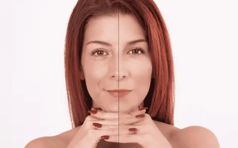 Prima e dopo: il collagene a cosa serve per una pelle visibilmente più liscia e luminosa.