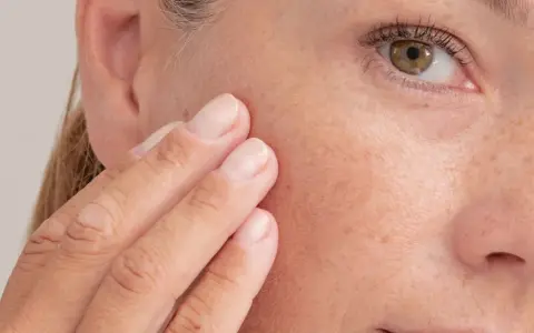 Dita sfiorano il viso, mostrando la pelle e le lentiggini. Un dettaglio per capire quando usare il retinolo per una pelle radiosa.