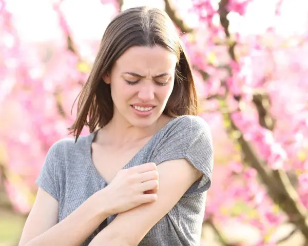 Donna con prurito in tutto il corpo, graffiandosi il braccio tra i fiori rosa.