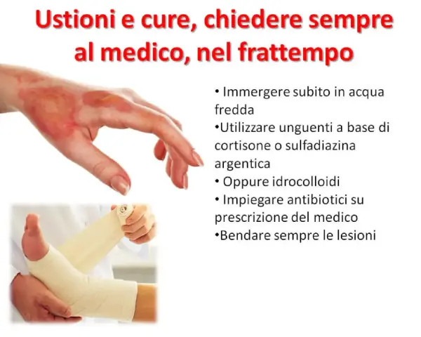 Immagine mostra una mano ustionata e un piede fasciato. Per le ustioni, cosa mettere: acqua fredda, unguenti specifici o idrocolloidi, e bendare. Consultare sempre un medico.