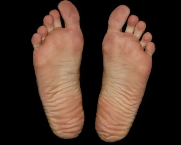 Piante dei piedi con evidenti calli e rughe, segno di lunghe camminate.