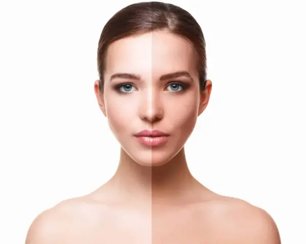 Volto diviso a metà: da un lato pelle chiara, dall'altro abbronzata, per mostrare come aumentare la melanina.