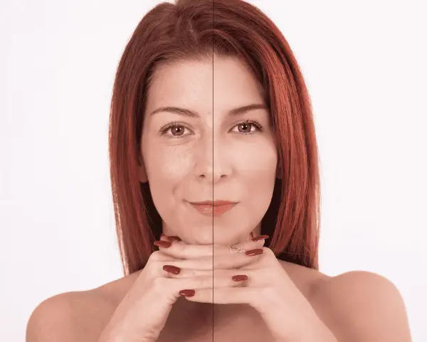 Prima e dopo: il collagene a cosa serve per una pelle visibilmente più liscia e luminosa.