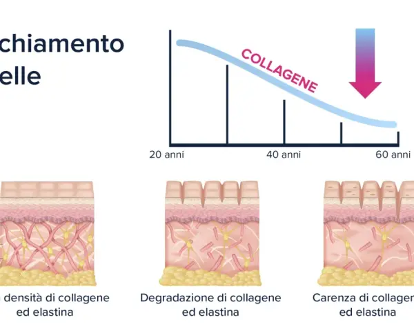 La pelle invecchia: il collagene diminuisce con l'età, causando rughe e perdita di elasticità. Sembra che sono invecchiata di colpo!