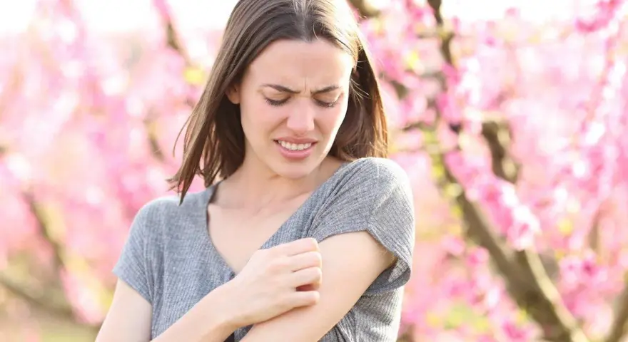 Donna con prurito in tutto il corpo, graffiandosi il braccio tra i fiori rosa.