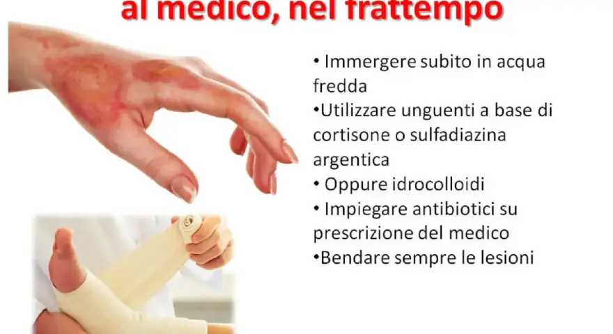 Immagine mostra una mano ustionata e un piede fasciato. Per le ustioni, cosa mettere: acqua fredda, unguenti specifici o idrocolloidi, e bendare. Consultare sempre un medico.