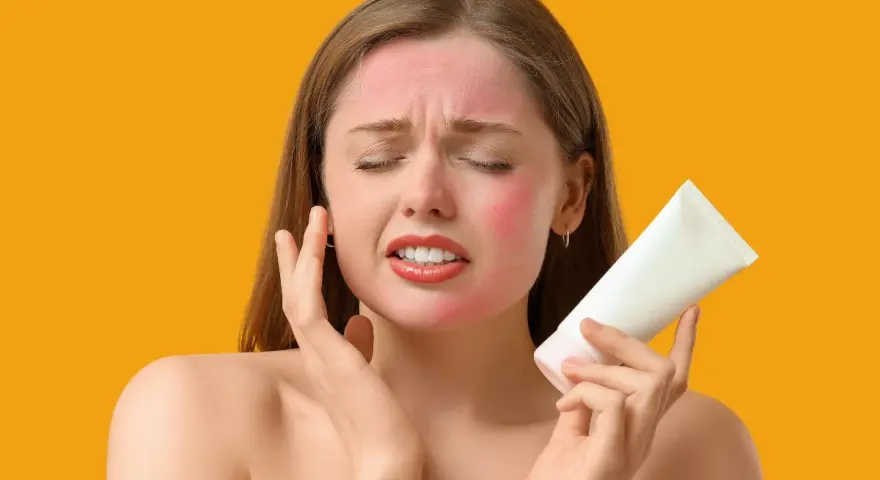 Donna con viso arrossato per eritema solare, che tiene in mano una crema. Potrebbero comparire brufoli a causa dell'irritazione.