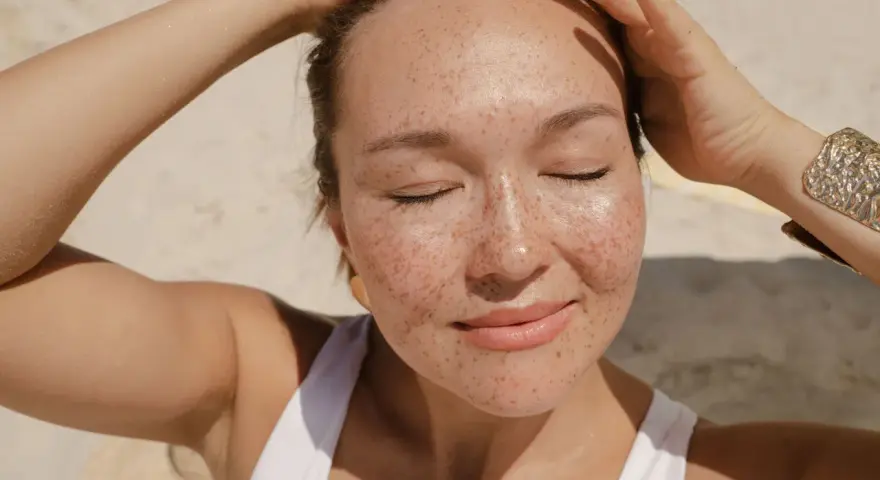 Donna con lentiggini al sole, con le mani tra i capelli. Forse la crema solare tutti i giorni fa male?