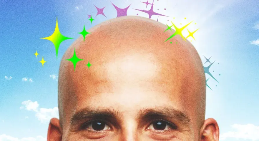 Testa calva con stelle colorate, come dopo una scottatura cuoio capelluto e perdita capelli, ma ora splendente.
