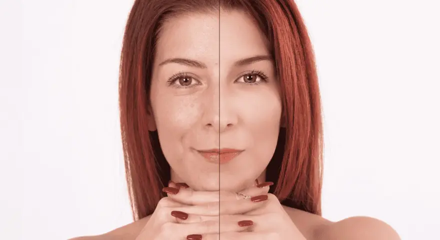 Prima e dopo: il collagene a cosa serve per una pelle visibilmente più liscia e luminosa.