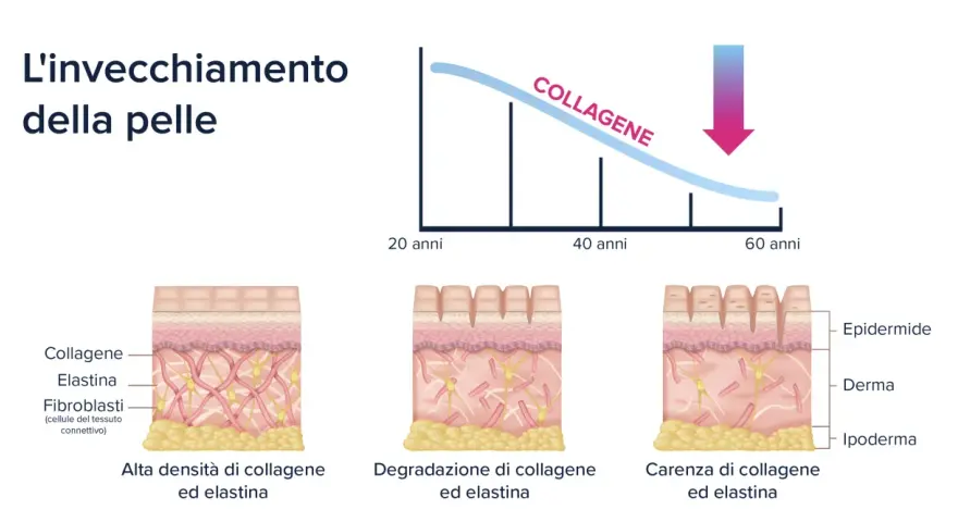 La pelle invecchia: il collagene diminuisce con l'età, causando rughe e perdita di elasticità. Sembra che sono invecchiata di colpo!