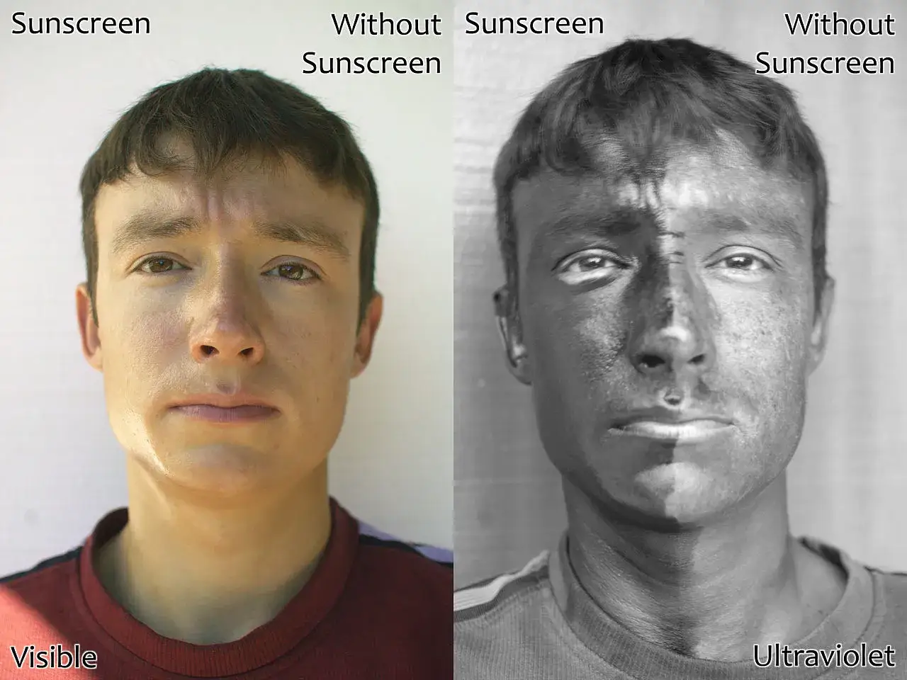 Viso diviso: metà protetta da crema solare, l'altra metà mostra l'effetto dei raggi uva sotto luce ultravioletta.