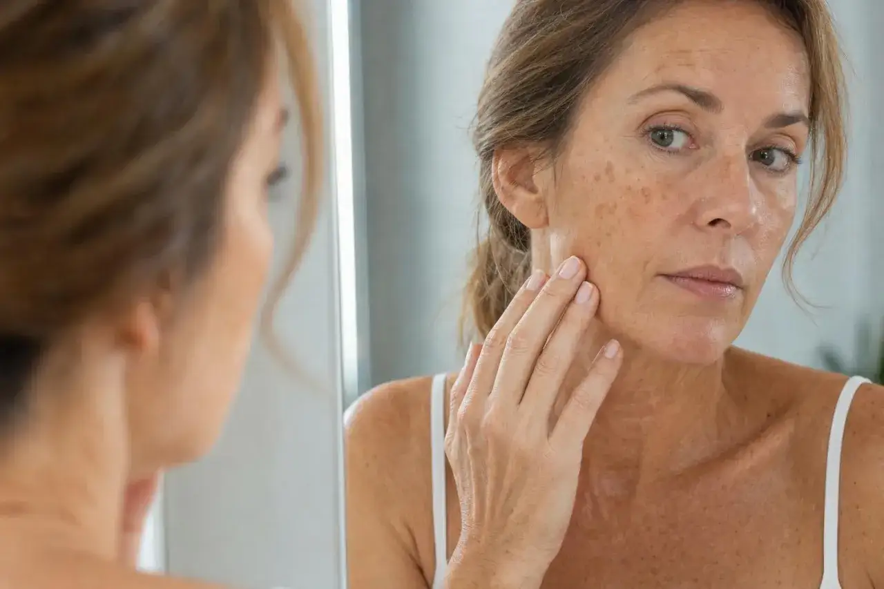 Donna si guarda allo specchio, toccandosi il viso dove compaiono macchie solari. Spera che le macchie solari vadano via da sole.
