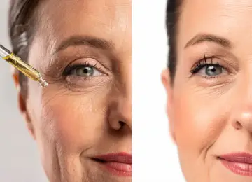 Prima e dopo: un siero dona alla pelle luminosa un aspetto più giovane e levigato.