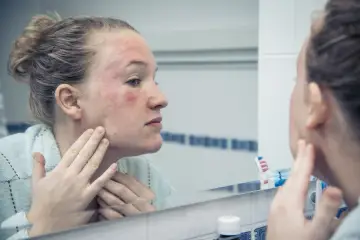 Donna con viso arrossato e irritato si guarda allo specchio, preoccupata che la glicerina viso fa male.