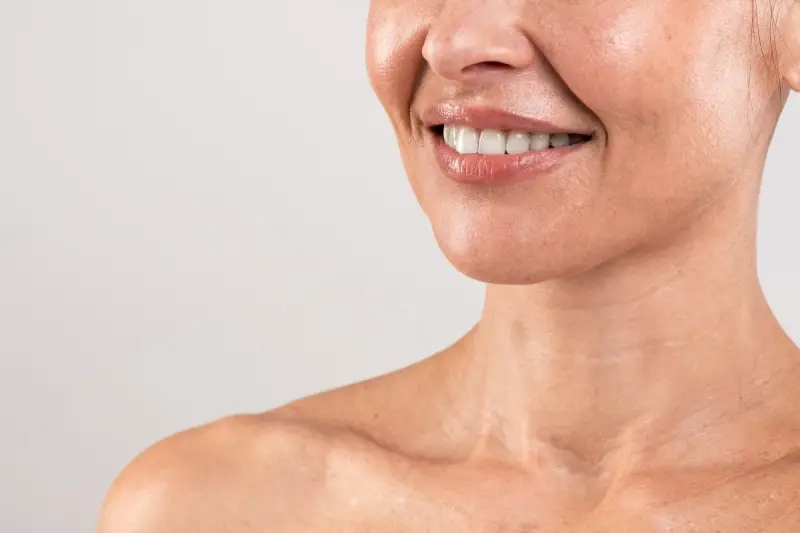 Sorriso radioso, pelle luminosa e le prime collane di Venere a 20 anni, segno di giovinezza e vitalità.